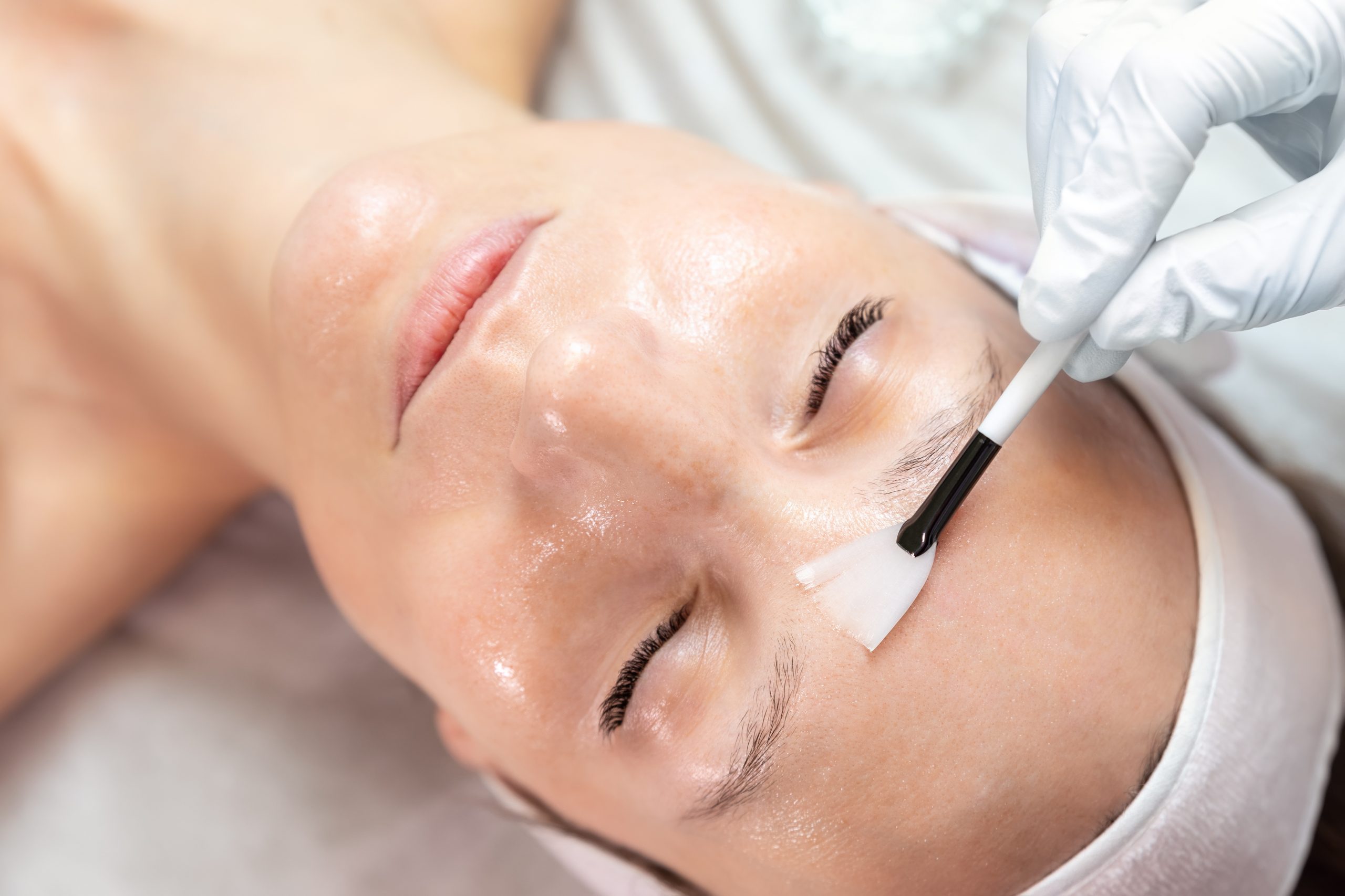 Featured image for “Exploring the Revitalizing Benefits of Chemical Peels￼”