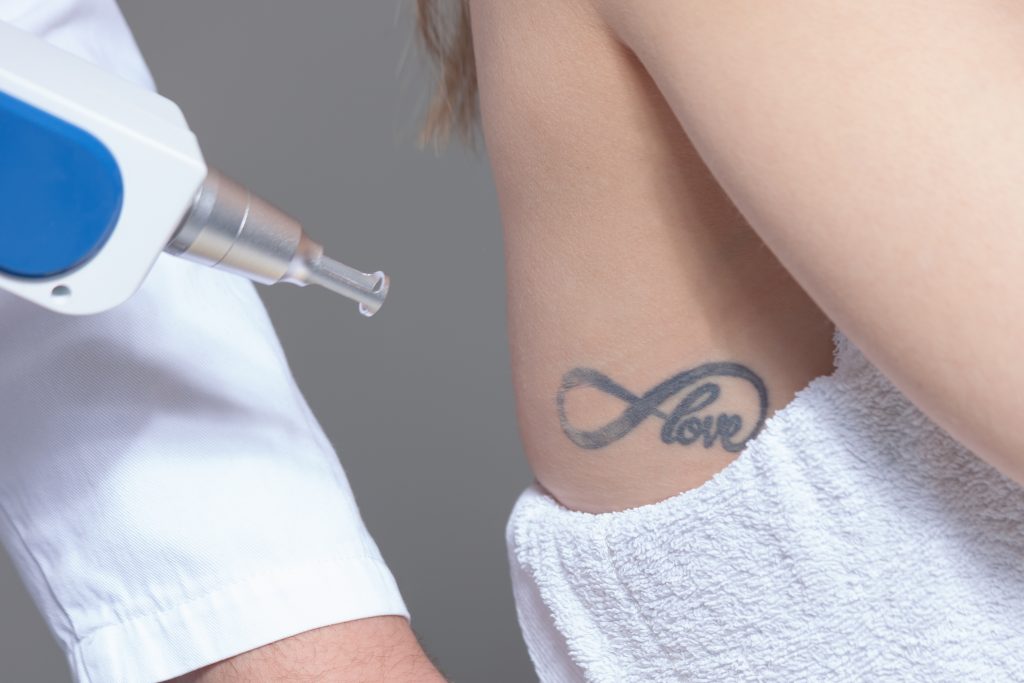 The latest laser tattoo removal technology now available here in Pukekohe   Harleh Laser Clinic Pukekohe