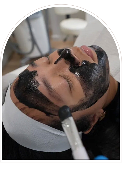 facial treatment